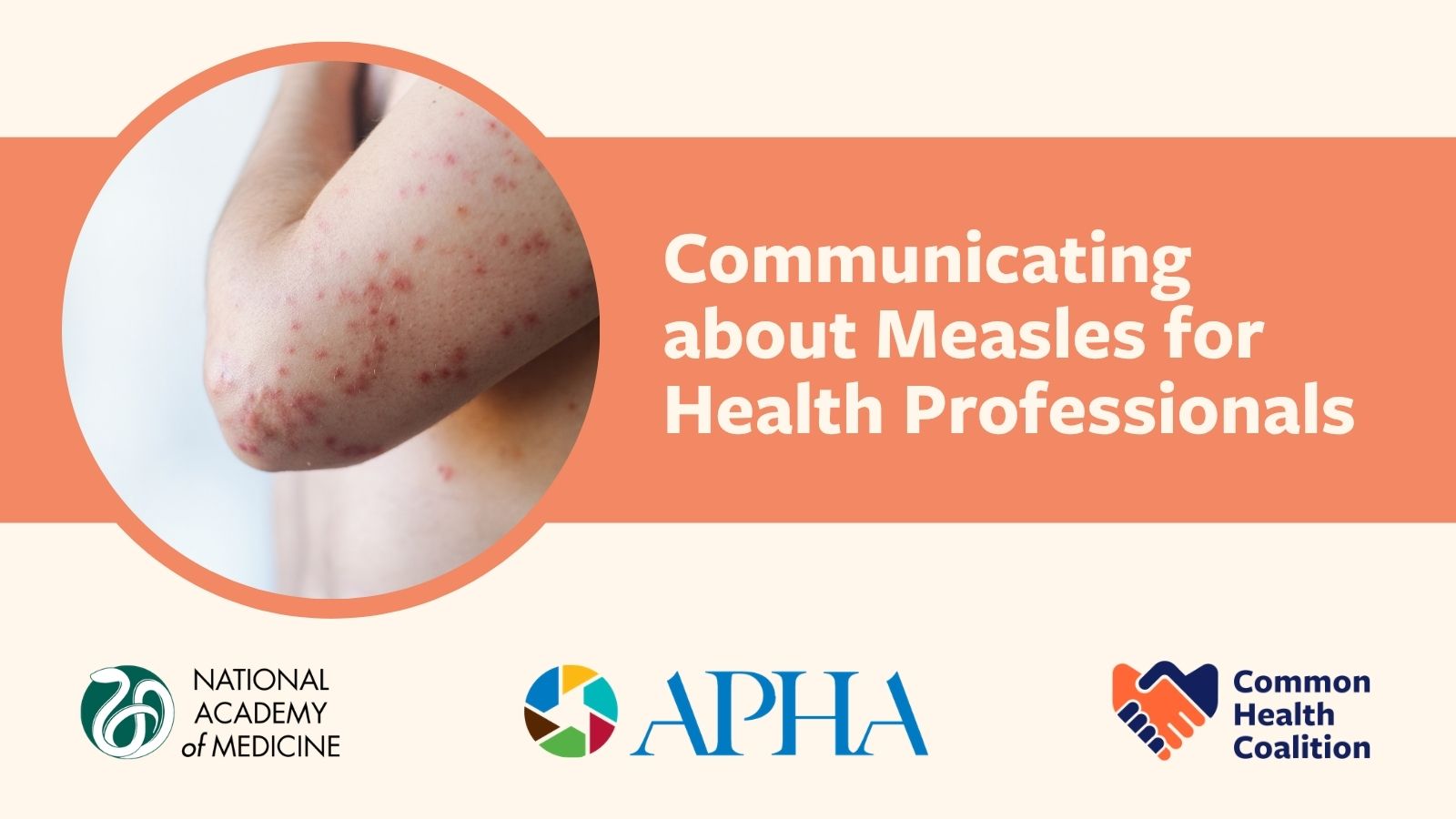 Measles webinar graphic with title and logos