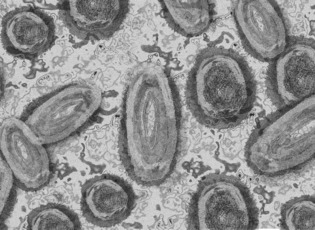 Disease under a microscope